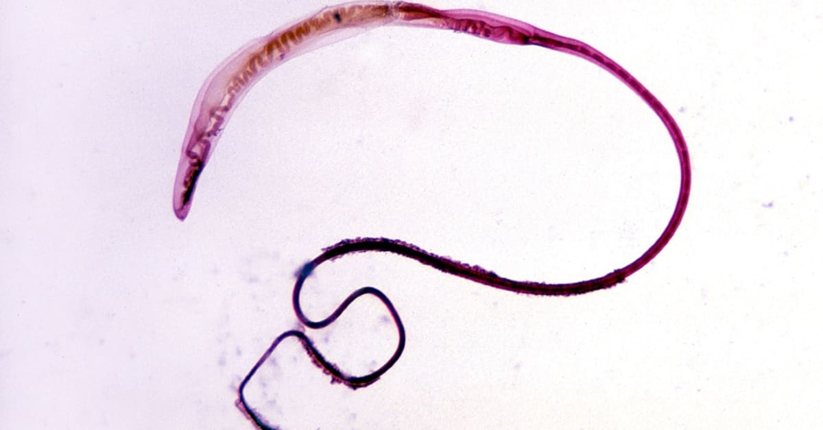 Doctors in Australia Remove Live Worm From Woman's Brain - Men's Journal