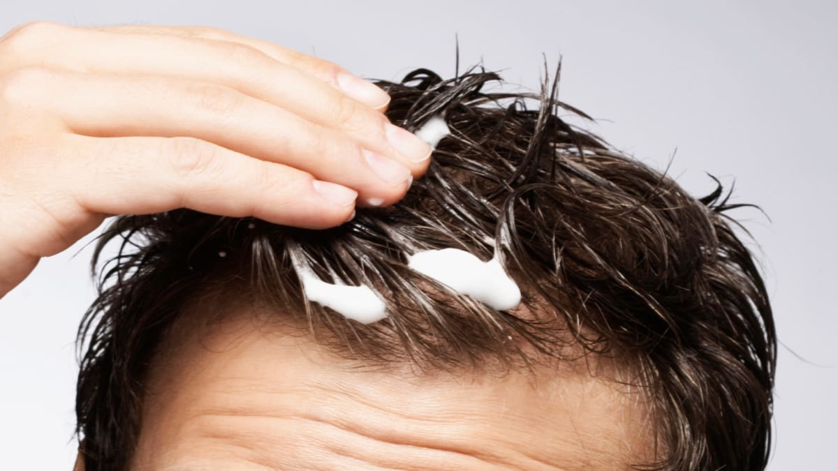 I'm an expert and here's why your hair gel is making you go bald