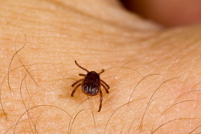 Lyme Disease Might Be Preventable With Human Sweat, New Study Finds ...