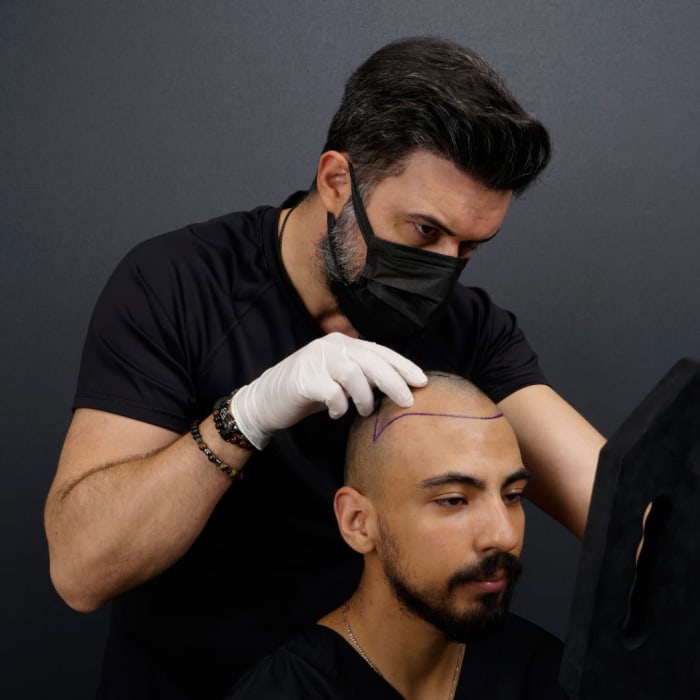 A Guide To Get Hair Transplant In Turkey Mens Journal 8034