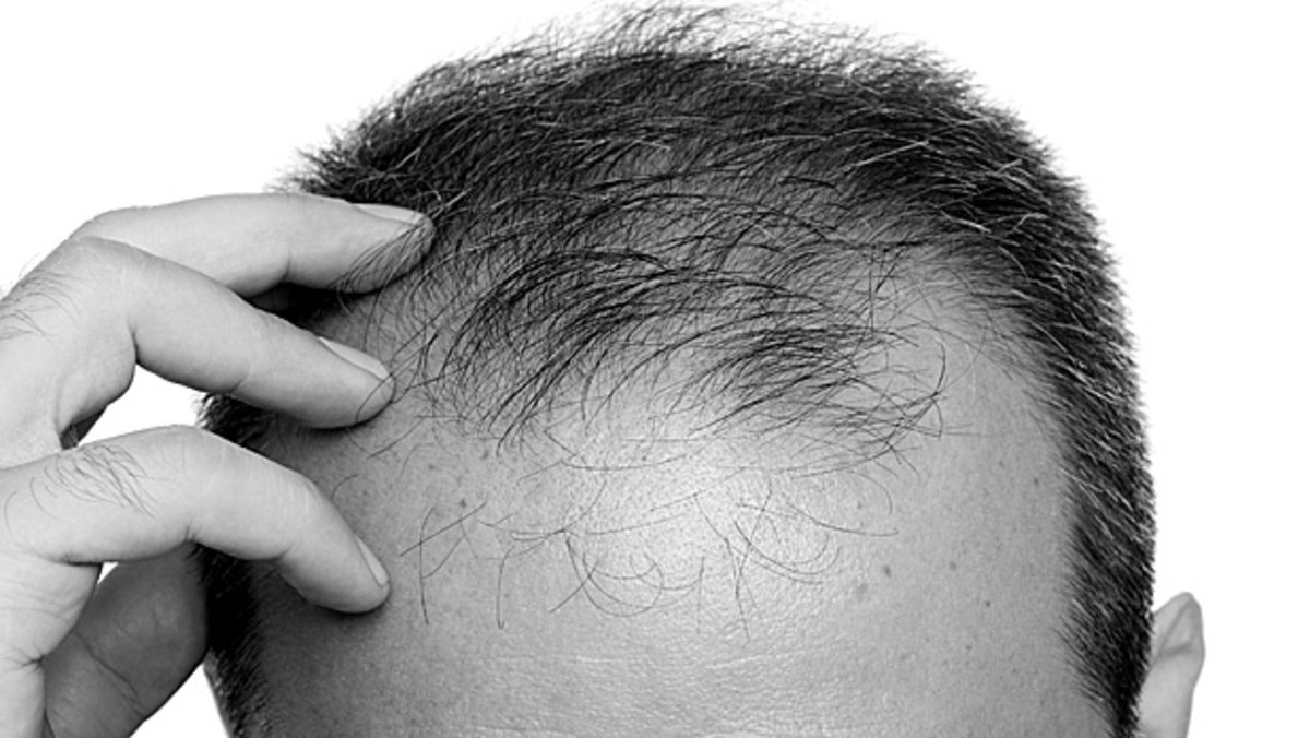 Myths And Facts About Hair Loss Mens Journal 1561