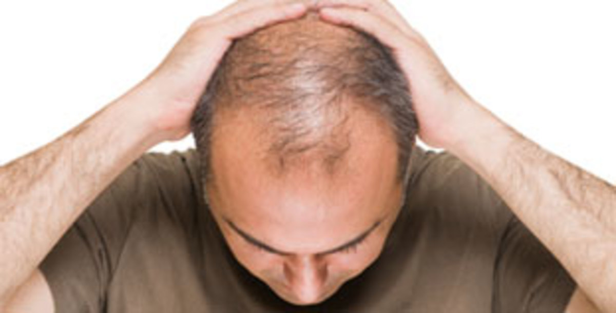 4 Ways to Fight Hair Loss - Men's Journal