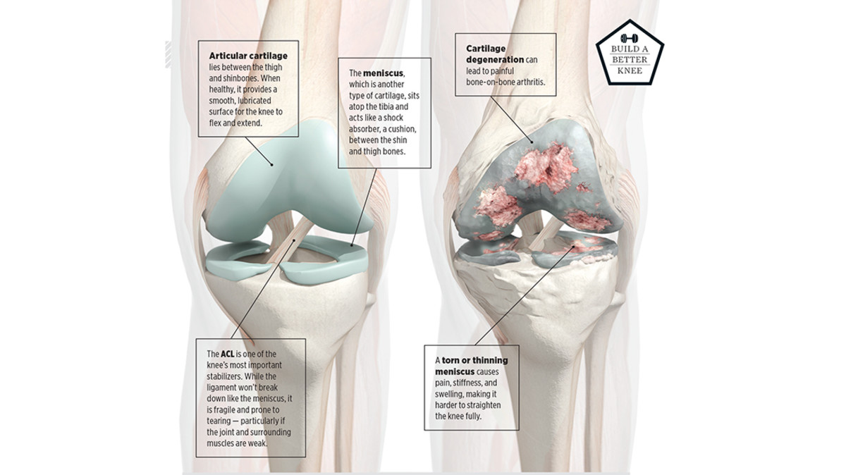 Why Good Knees Go Bad An Illustration Mens Journal