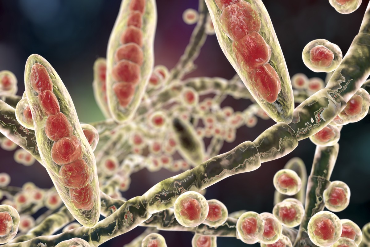 First U.S. Case of Rare Sexually Transmitted Fungal Infection Reported ...