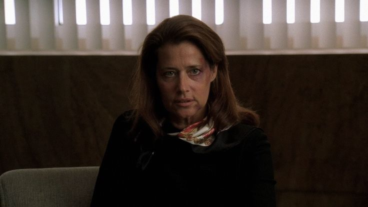 Dr. Melfi with a bruised face.